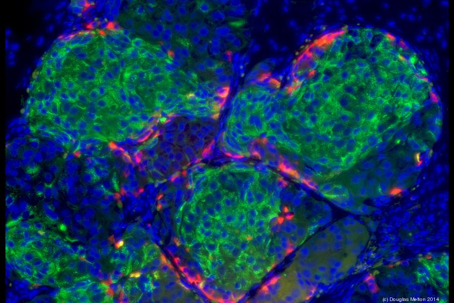 human-sc-beta-cells2900xx3000-2000-0-134