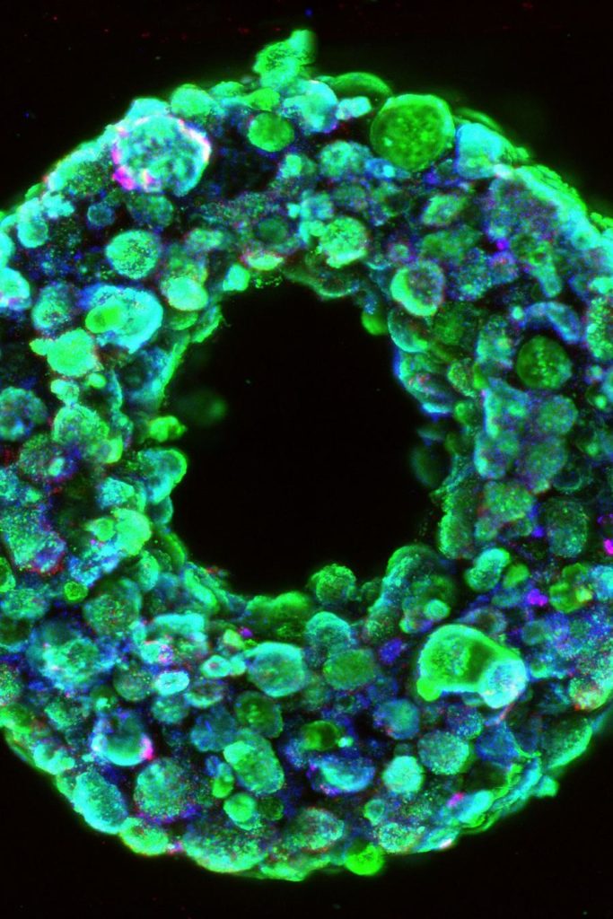 swift-cardiac-tissue-cross-section900xx1366-2049-341-0